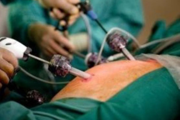 Объявление