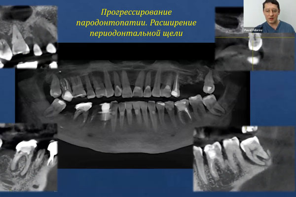 В УНИВЕРСИТЕТЕ ОБСУДИЛИ ВОПРОСЫ ПРОФИЛАКТИКИ И ДИАГНОСТИКИ БОЛЕЗНЕЙ ПАРОДОНТА