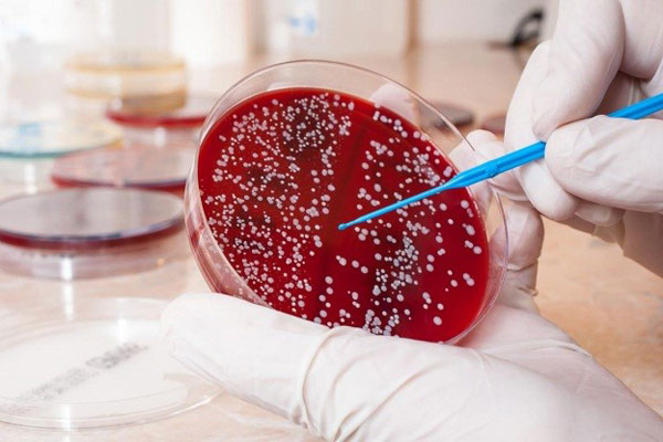 ВНУТРИВУЗОВСКАЯ ОЛИМПИАДА ПО МИКРОБИОЛОГИИ ДЛЯ СТУДЕНТОВ МЕДИКО-ПРОФИЛАКТИЧЕСКОГО ФАКУЛЬТЕТА