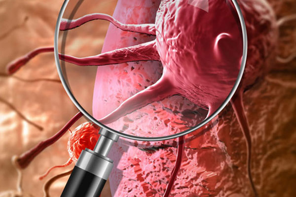 ПРИГЛАШАЕМ К УЧАСТИЮ В ОЛИМПИАДЕ ПО ОНКОЛОГИИ