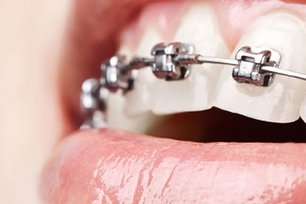 РязГМУ на конференции «Современные возможности ортодонтии и ортогнатической хирургии»