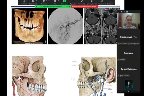 ВОЗМОЖНЫЕ СТОМАТОЛОГИЧЕСКИЕ ПОСЛЕДСТВИЯ КОВИДА